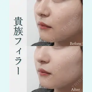 L‘amour clinic Tokyo【ラムールクリニック東京】の症例