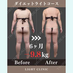 LIGHT CLINIC 【ライトクリニック】 大阪院 吹田　真一医師の症例