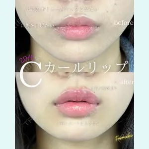 ルラ美容クリニック 新宿院の症例
