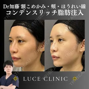ルーチェクリニック 銀座院 加藤晴之輔医師の症例