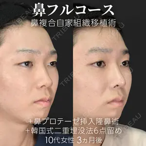 ジョウクリニック 大阪院 新開 博之医師の症例