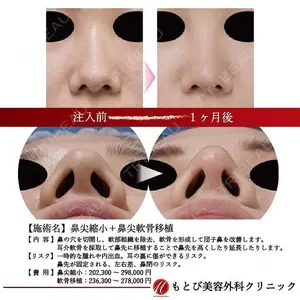 もとび美容外科クリニック 新宿院 西尾 謙三郎医師の症例