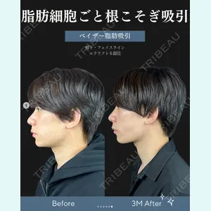 症例