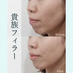 L‘amour clinic Tokyo【ラムールクリニック東京】の症例