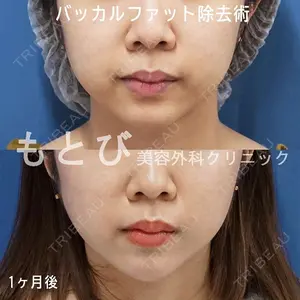 もとび美容外科クリニック 新宿院 西尾 謙三郎医師の症例