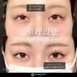東京形成美容外科 船橋院 弓削田　浩主医師の症例