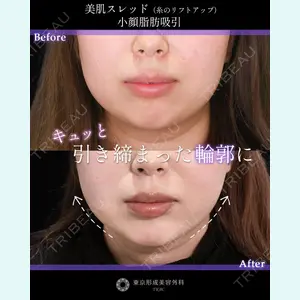 症例