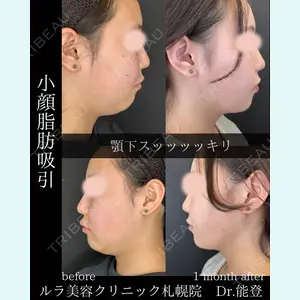 ルラ美容クリニック 札幌院 能登 貴弘医師の症例