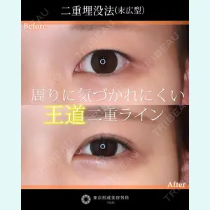 東京形成美容外科 船橋院 山田 大輔医師の症例