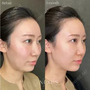 NEXUS CLINIC 岩井 勝矢医師の症例