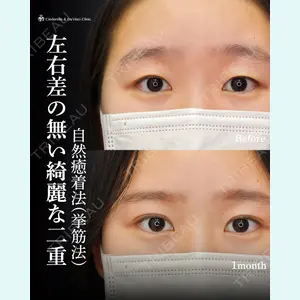 シンデレラ＆ダヴィンチクリニック 宮田 洋佑医師の症例