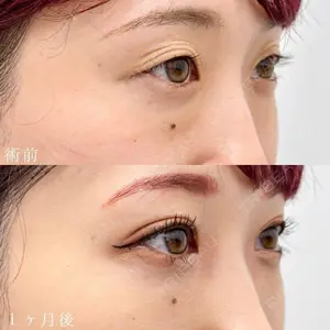 TCB東京中央美容外科 名古屋栄院 山本 展生医師の症例