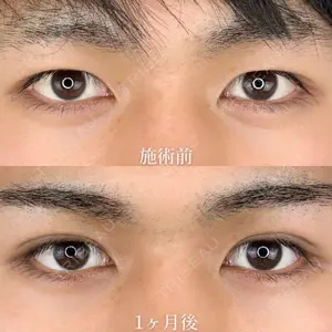 TCB東京中央美容外科 熊本院 垣花 瑠美子医師の症例