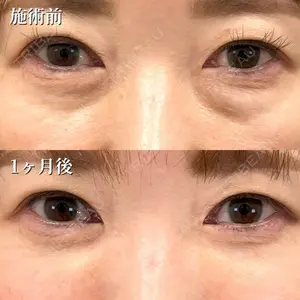 TCB東京中央美容外科 長野院 花岡 拓也医師の症例