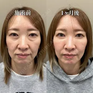TCB東京中央美容外科 長野院 花岡 拓也医師の症例
