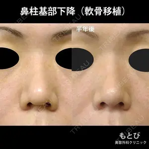 もとび美容外科クリニック 新宿院 西尾 謙三郎医師の症例