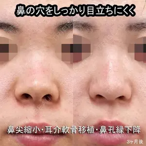 もとび美容外科クリニック 新宿院 西尾 謙三郎医師の症例