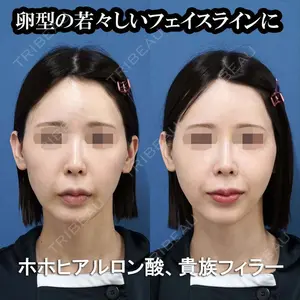 もとび美容外科クリニック 新宿院 西尾 謙三郎医師の症例