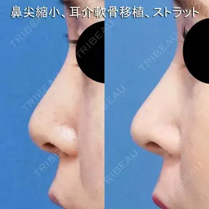 もとび美容外科クリニック 新宿院 西尾 謙三郎医師の症例