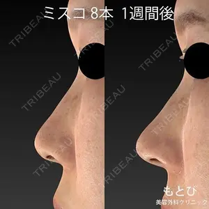 もとび美容外科クリニック 新宿院 西尾 謙三郎医師の症例