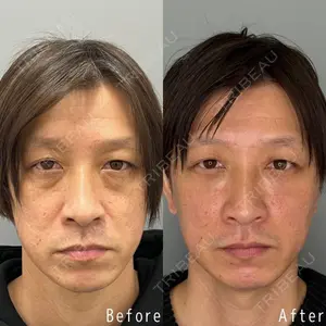 症例