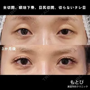 もとび美容外科クリニック 新宿院 西尾 謙三郎医師の症例