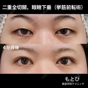 もとび美容外科クリニック 新宿院 西尾 謙三郎医師の症例
