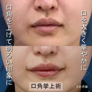症例