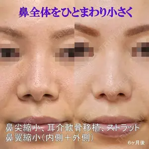 もとび美容外科クリニック 新宿院 西尾 謙三郎医師の症例