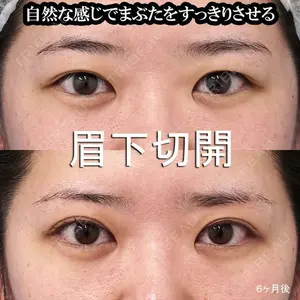 もとび美容外科クリニック 新宿院 西尾 謙三郎医師の症例