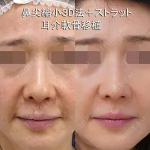 もとび美容外科クリニック 新宿院 西尾 謙三郎医師の症例
