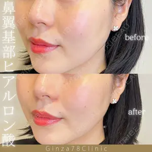 Ginza 78 Clinicの症例