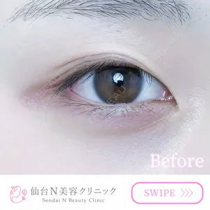 仙台N美容クリニックの症例