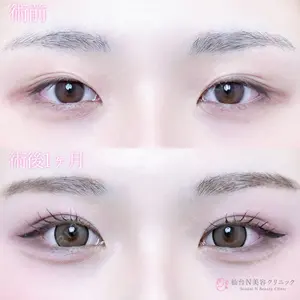 仙台N美容クリニック 小阪 捺稀医師の症例