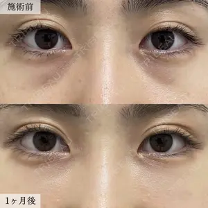 TCB東京中央美容外科 横浜駅前院 大見 貴秀医師の症例