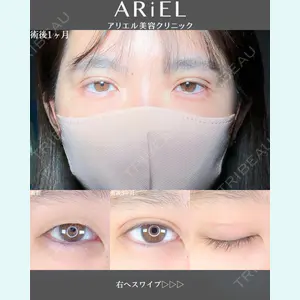 アリエル美容クリニック 郡山院 安齋 誠基医師の症例