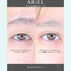 アリエル美容クリニック 郡山院 安齋 誠基医師の症例