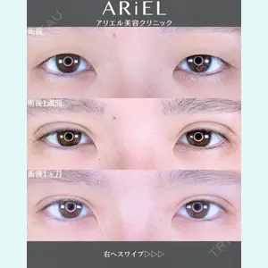 アリエル美容クリニック 郡山院 安齋 誠基医師の症例