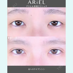 アリエル美容クリニック 郡山院 安齋 誠基医師の症例