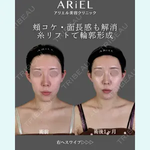 アリエル美容クリニック 郡山院 安齋 誠基医師の症例