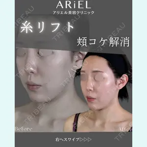 アリエル美容クリニック 郡山院 安齋 誠基医師の症例
