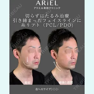 アリエル美容クリニック 郡山院 安齋 誠基医師の症例
