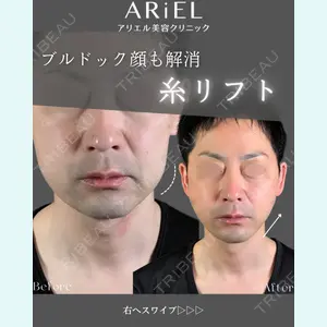 アリエル美容クリニック 郡山院 安齋 誠基医師の症例