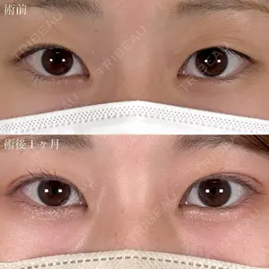 症例