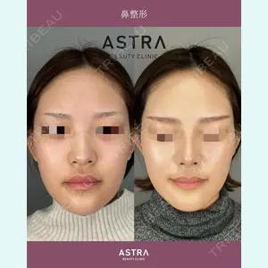 ASTRA BEAUTY CLINIC 権　友貴医師の症例