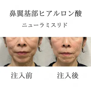 おおたかの森ビューティークリニック 橋本 昭彦医師の症例