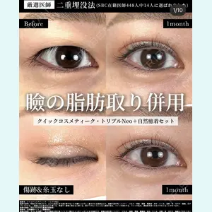 湘南美容クリニック 大阪梅田院 横谷 仁彦医師の症例