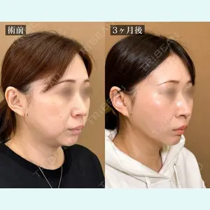 TCB東京中央美容外科 宇都宮院 岡本 卓也医師の症例