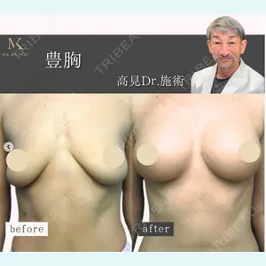MKクリニック 銀座院 高見 昌司医師の症例