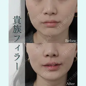 L‘amour clinic Tokyo【ラムールクリニック東京】の症例